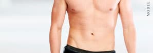 Tummy Tuck Model